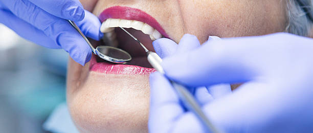 Best Emergency Wisdom Teeth Removal in Pis, AR
